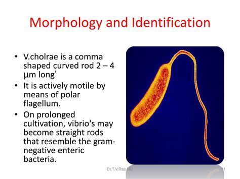 arrangement of vibrio cholerae